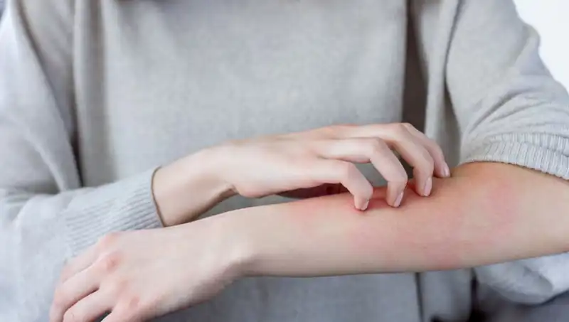 Cilt Kanserinin Gizli Belirtileri: Dermatologdan Önemli Uyarılar!